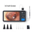 Digital Otoscope with 3.9mm Lens & HD Camera – Ear Wax Removal Tool for Kids & Adults