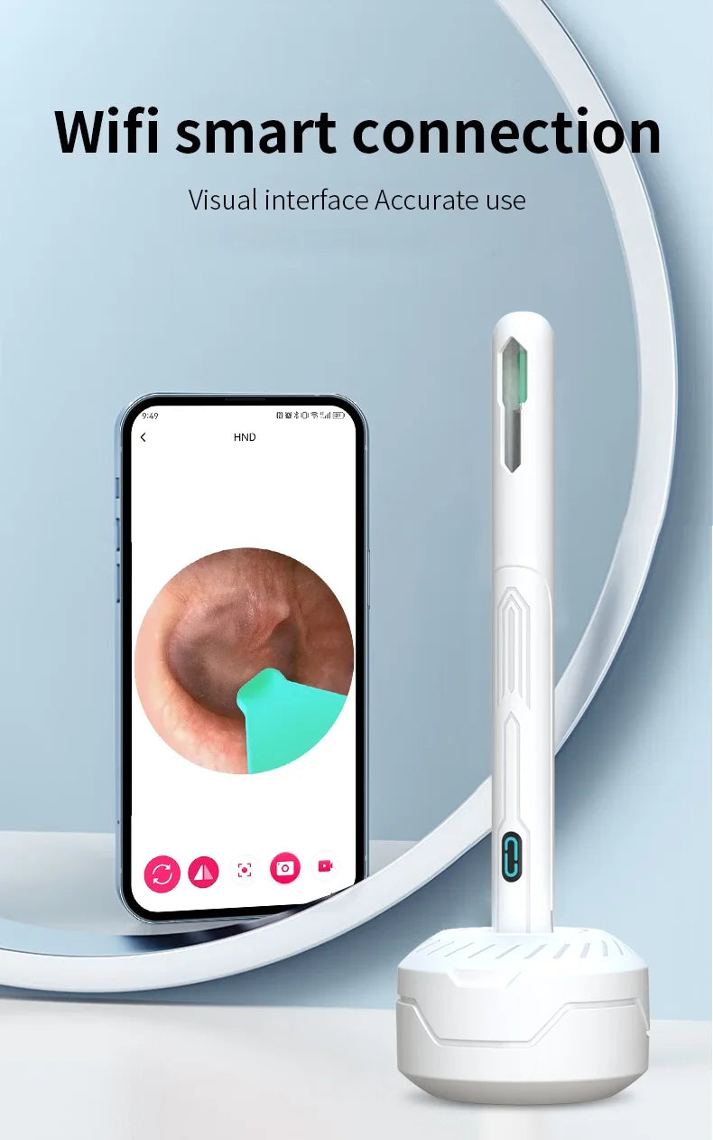 NATFIRE NK3 Pro Smart Visual Ear Cleaner – 1296P HD WiFi Otoscope Ear Wax Removal Kit