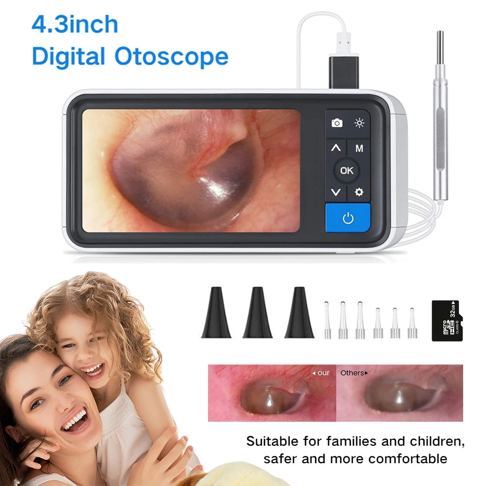 Digital Otoscope with 3.9mm Lens & HD Camera – Ear Wax Removal Tool for Kids & Adults