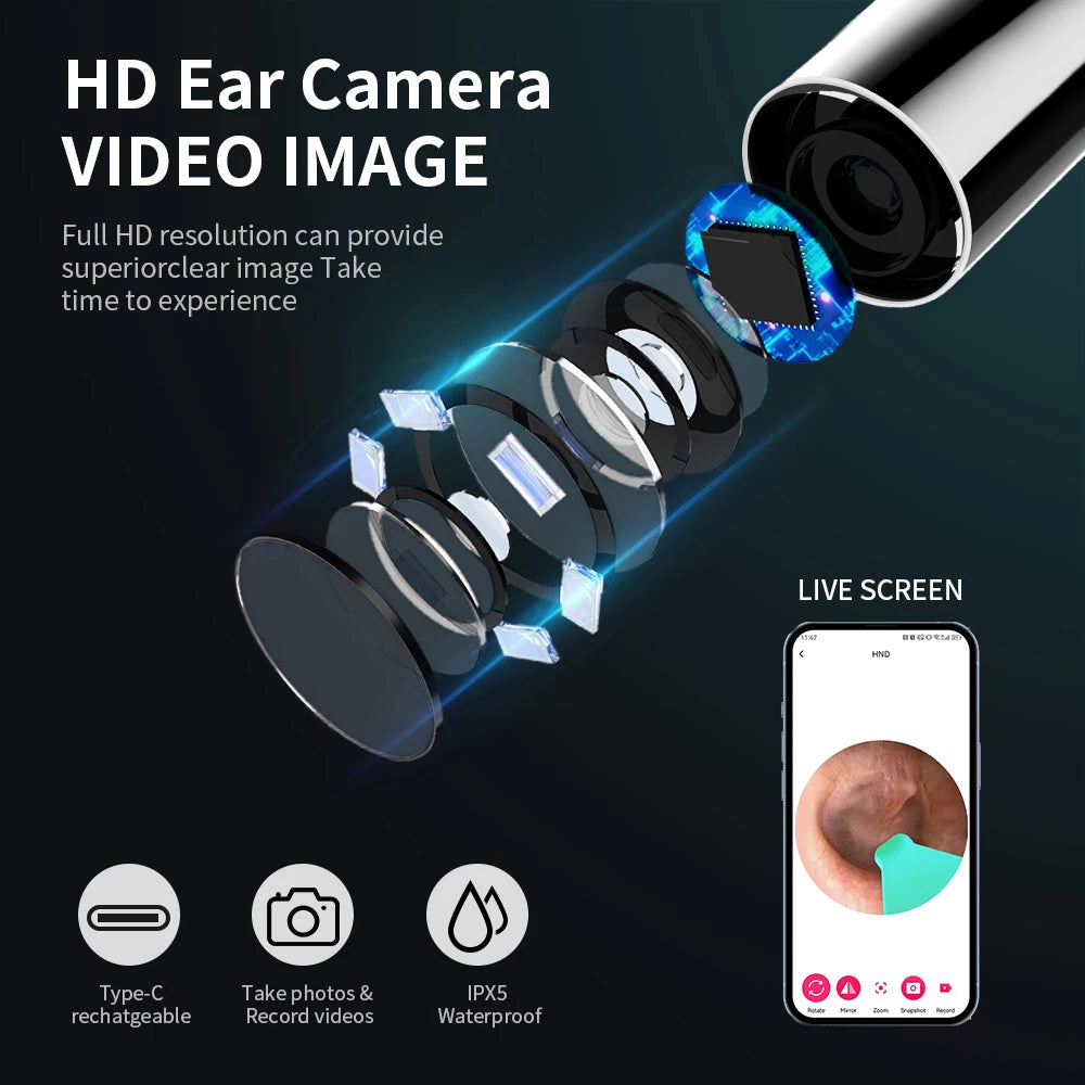 NATFIRE NK3 Pro Smart Visual Ear Cleaner – 1296P HD WiFi Otoscope Ear Wax Removal Kit