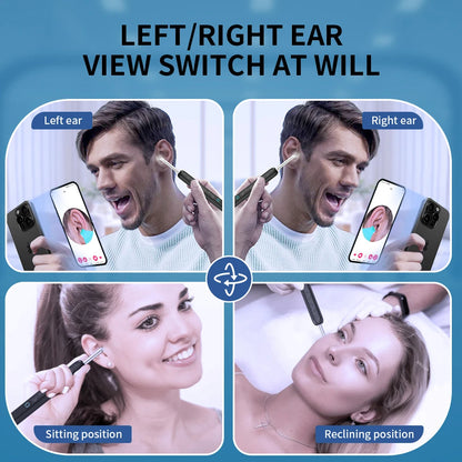 Wireless Ear Camera - HD Ear Wax Removal Tool with LED Light