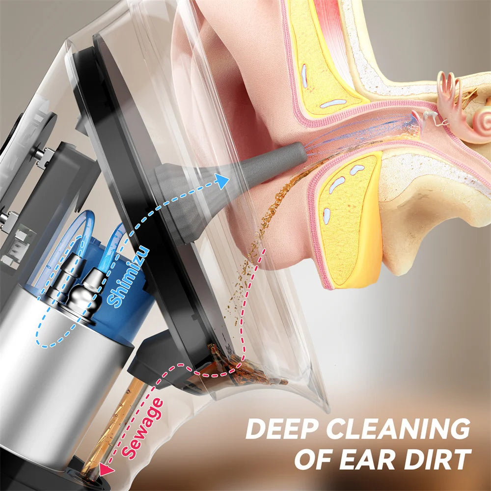 SUNUO Electric Ear Wax Removal Kit – Ear Irrigation System with Dual Water Tank, LED Display & 9 Spray Modes