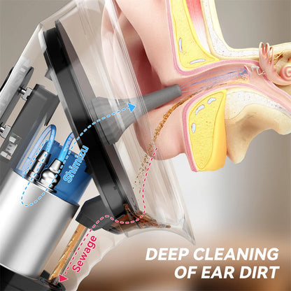 SUNUO Electric Ear Wax Removal Kit – Ear Irrigation System with Dual Water Tank, LED Display & 9 Spray Modes