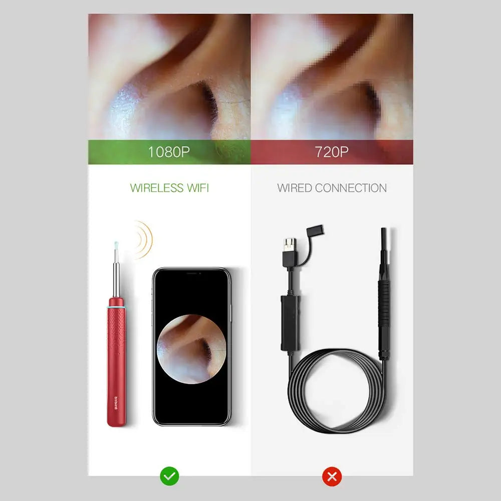 Bebird Smart Visual Ear Wax Removal Tool – Wireless Otoscope with Camera & 6 LED Lights