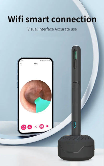 NATFIRE NK3 Pro Smart Visual Ear Cleaner – 1296P HD WiFi Otoscope Ear Wax Removal Kit