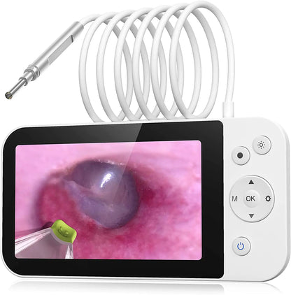 Digital Otoscope with 3.9mm Lens & HD Camera – Ear Wax Removal Tool for Kids & Adults