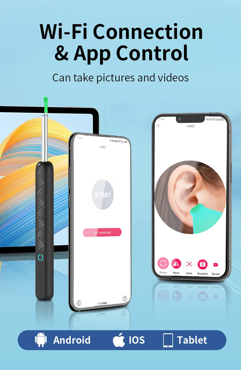 Wireless Ear Camera - HD Ear Wax Removal Tool with LED Light