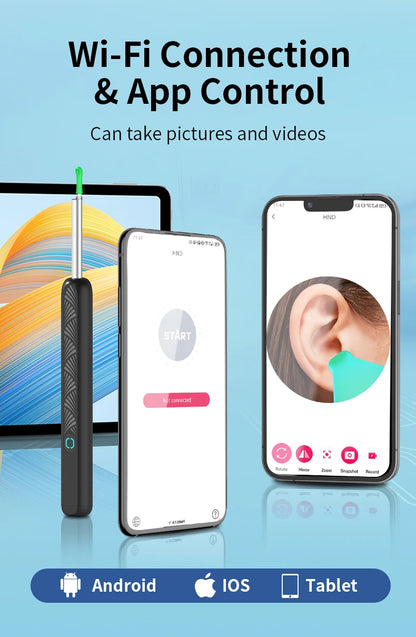 Wireless Ear Camera - HD Ear Wax Removal Tool with LED Light