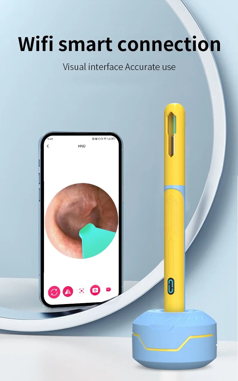 NATFIRE NK3 Pro Smart Visual Ear Cleaner – 1296P HD WiFi Otoscope Ear Wax Removal Kit