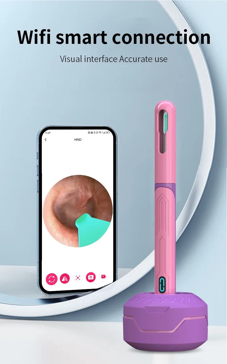 NATFIRE NK3 Pro Smart Visual Ear Cleaner – 1296P HD WiFi Otoscope Ear Wax Removal Kit